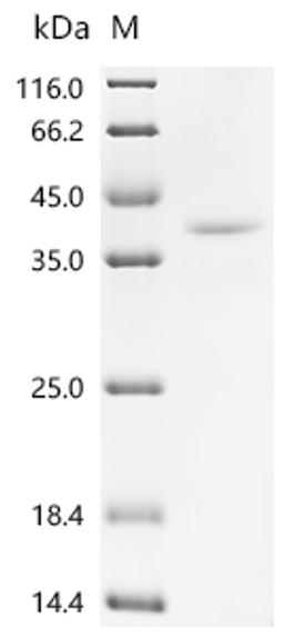 (Tris-Glycine gel) Discontinuous SDS-PAGE (reduced) with 5% enrichment gel and 15% separation gel.