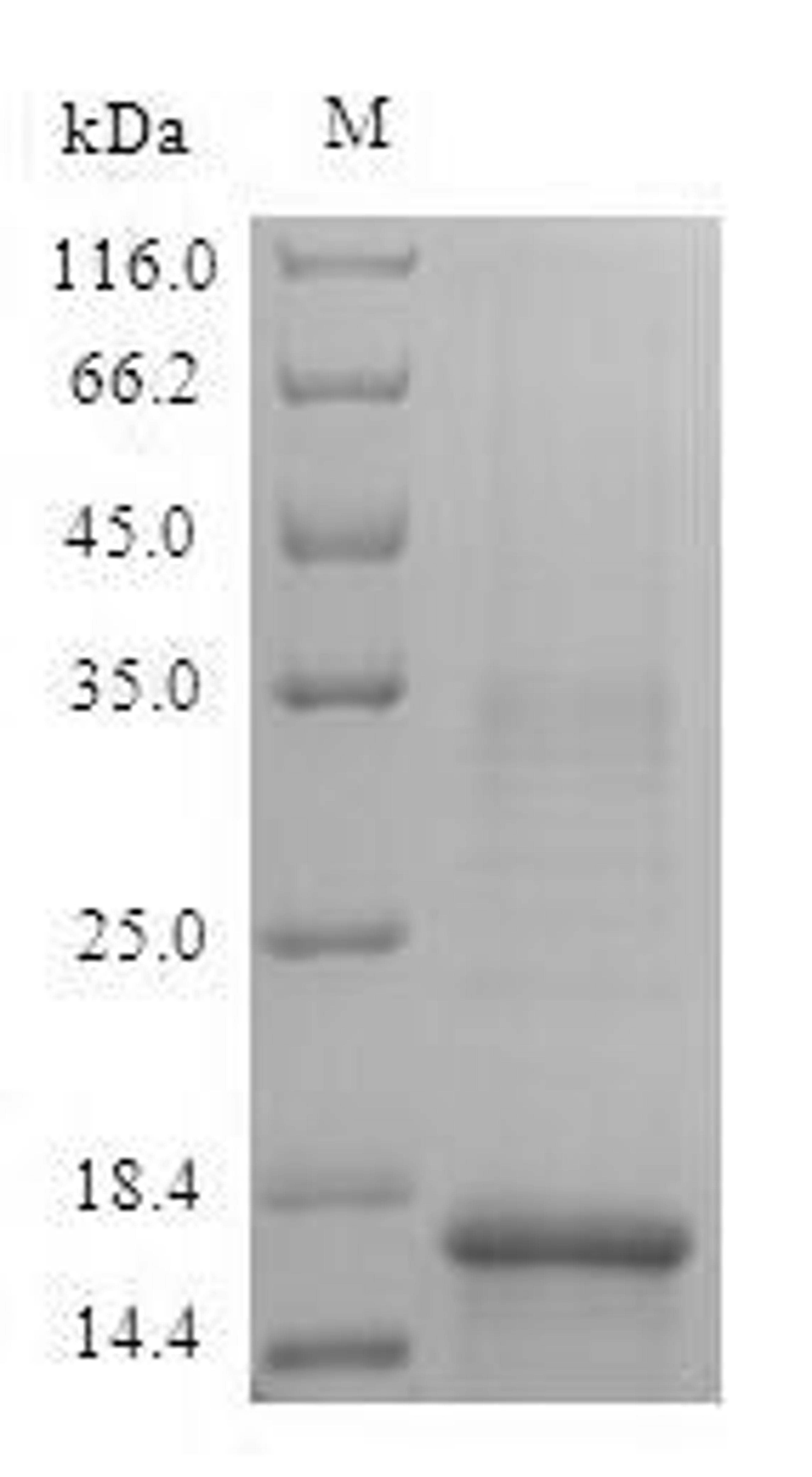 (Tris-Glycine gel) Discontinuous SDS-PAGE (reduced) with 5% enrichment gel and 15% separation gel.