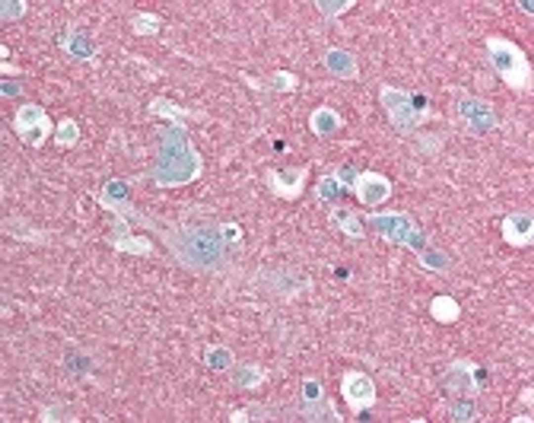 Immunohistochemistry staining of SNAP25 in brain cortex tissue using SNAP25 Monoclonal Antibody.