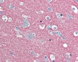 Immunohistochemistry staining of SNAP25 in brain cortex tissue using SNAP25 Monoclonal Antibody.