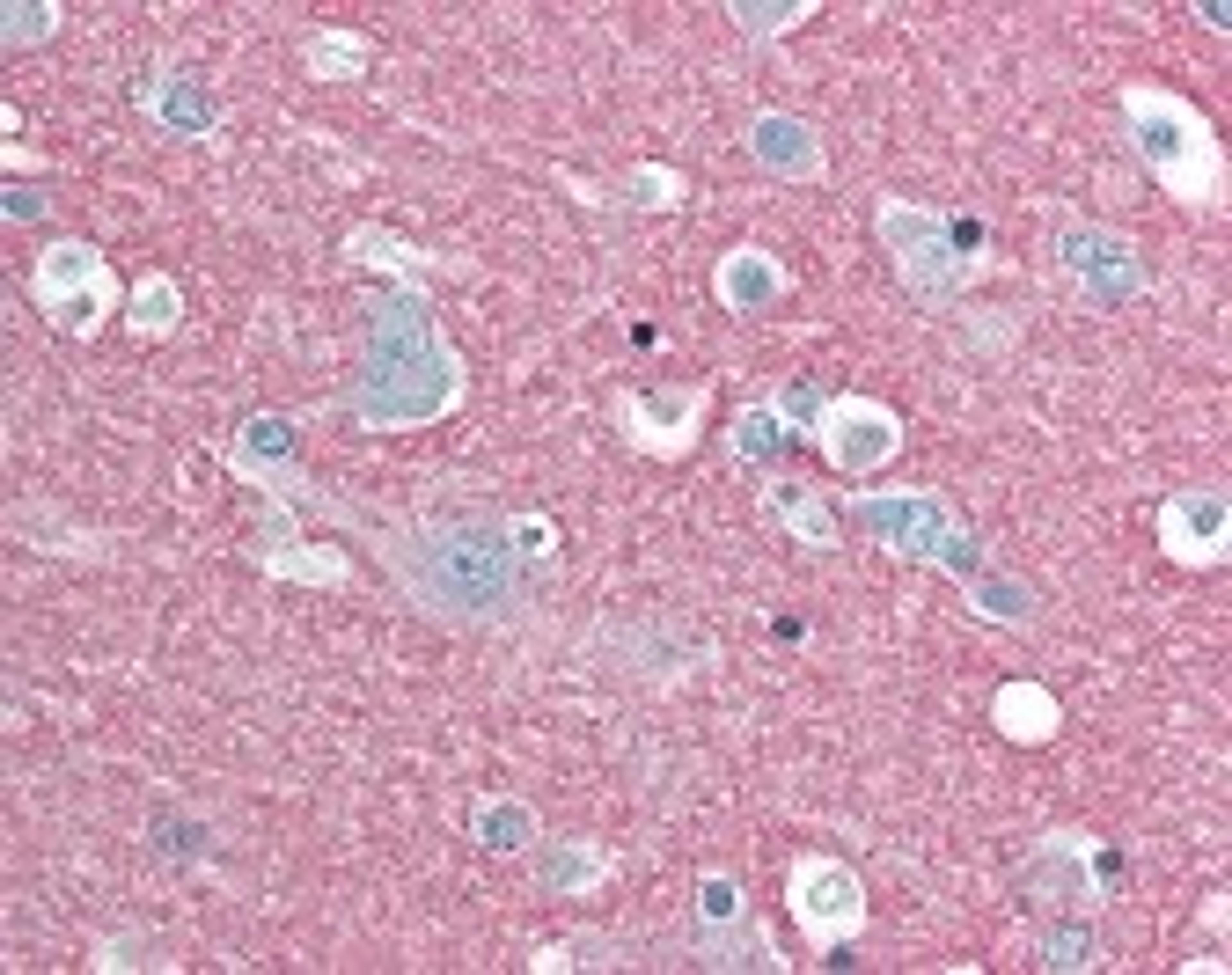 Immunohistochemistry staining of SNAP25 in brain cortex tissue using SNAP25 Monoclonal Antibody.