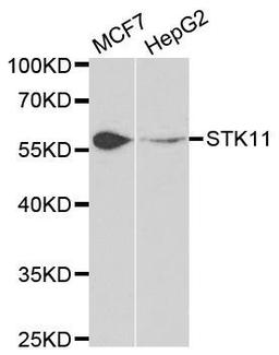 Western blot analysis of extracts of various cell lines using STK11 antibody