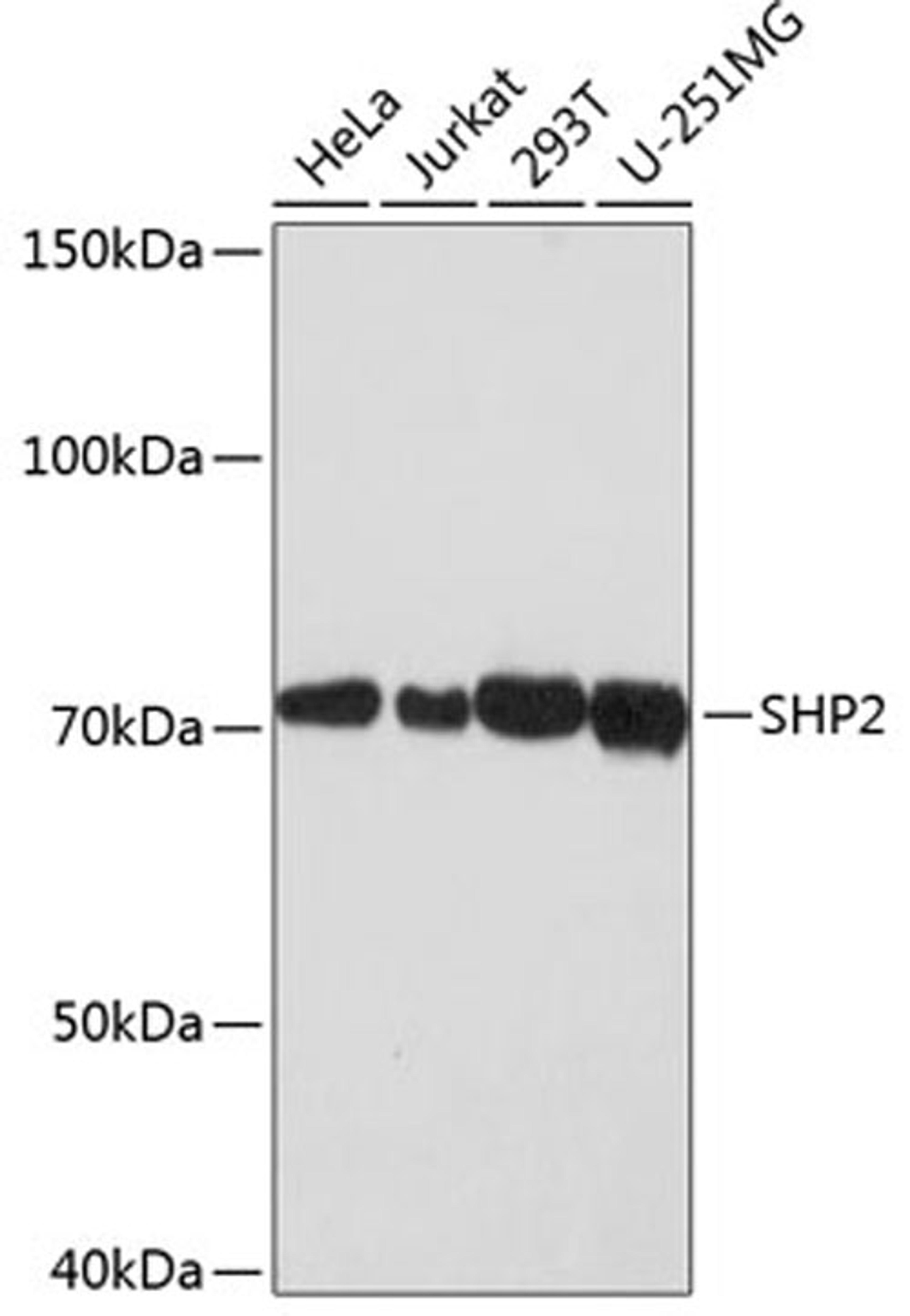 Western blot - SHP2 antibody (A19112)