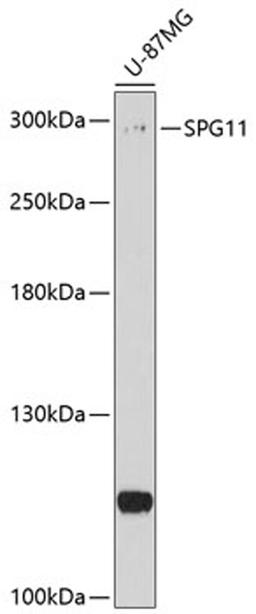 Western blot - SPG11 antibody (A10326)