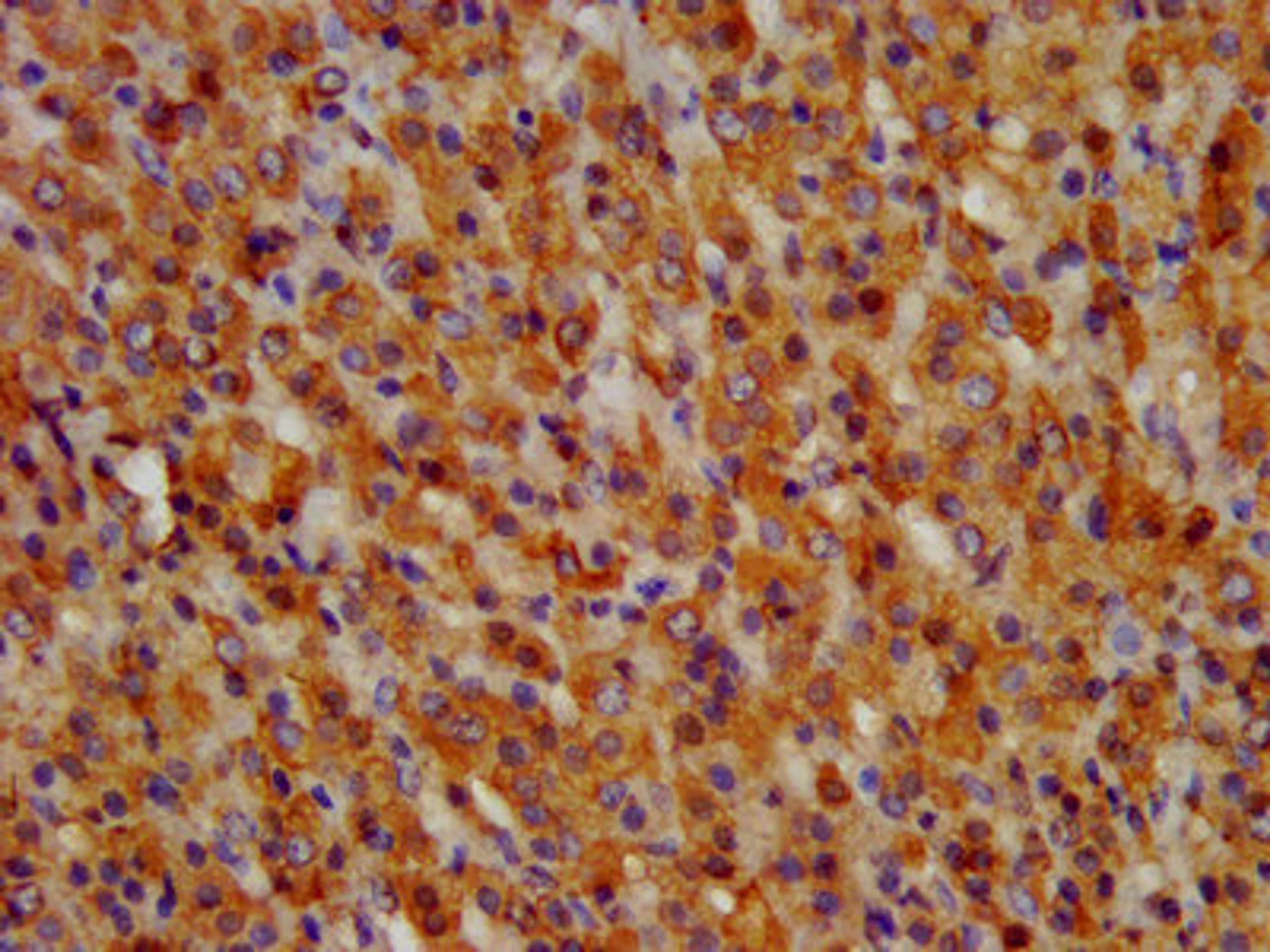 IHC image of CSB-PA009943LA01HU diluted at 1:300 and staining in paraffin-embedded human adrenal gland tissue performed on a Leica BondTM system. After dewaxing and hydration, antigen retrieval was mediated by high pressure in a citrate buffer (pH 6.0). Section was blocked with 10% normal goat serum 30min at RT. Then primary antibody (1% BSA) was incubated at 4&deg;C overnight. The primary is detected by a biotinylated secondary antibody and visualized using an HRP conjugated SP system.