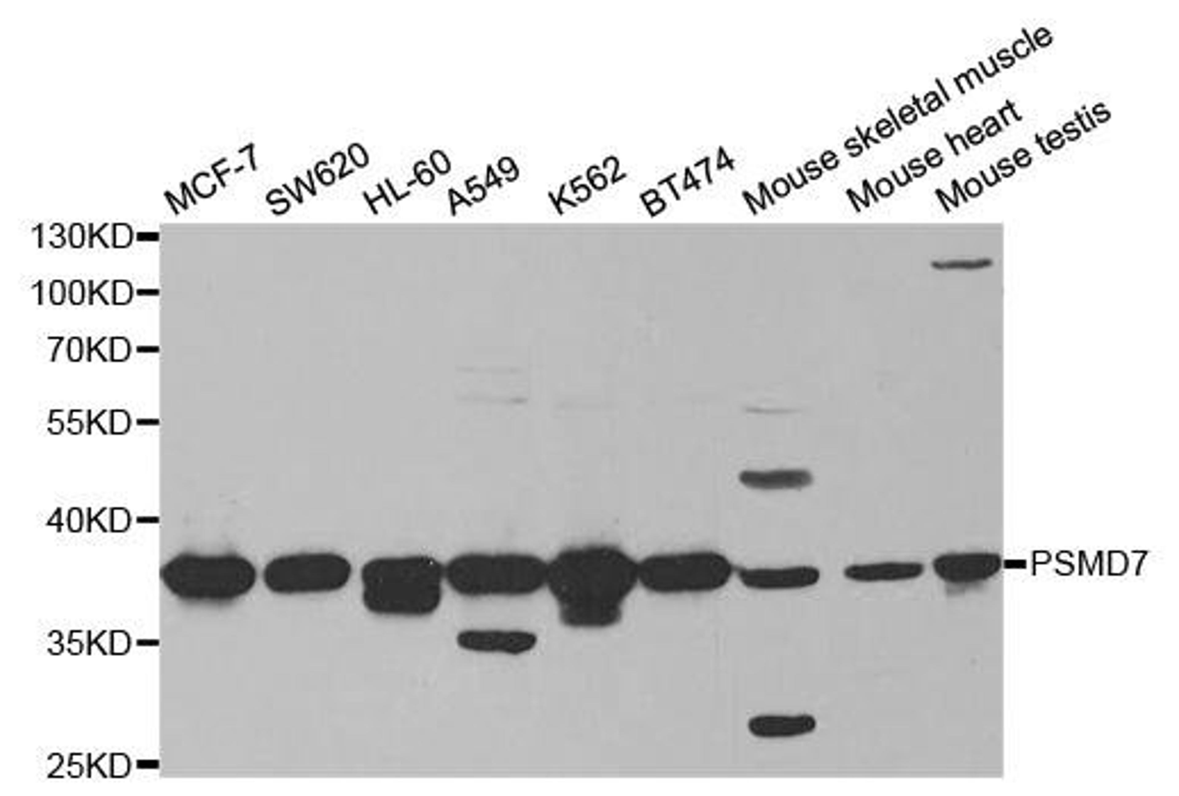 Western blot analysis of extracts of various cell lines using PSMD7 antibody