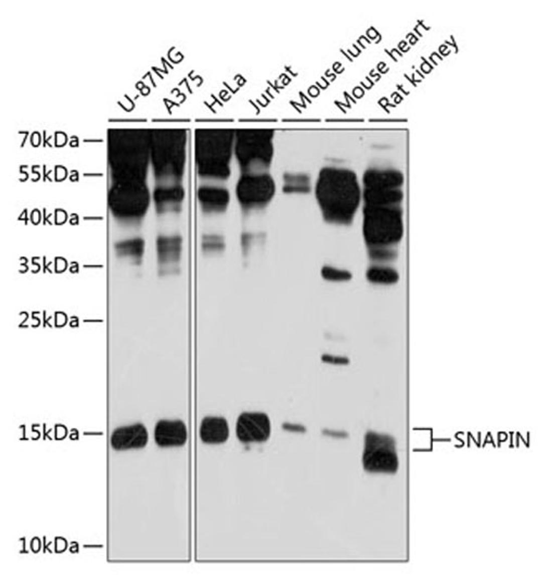 Western blot - SNAPIN antibody (A10294)