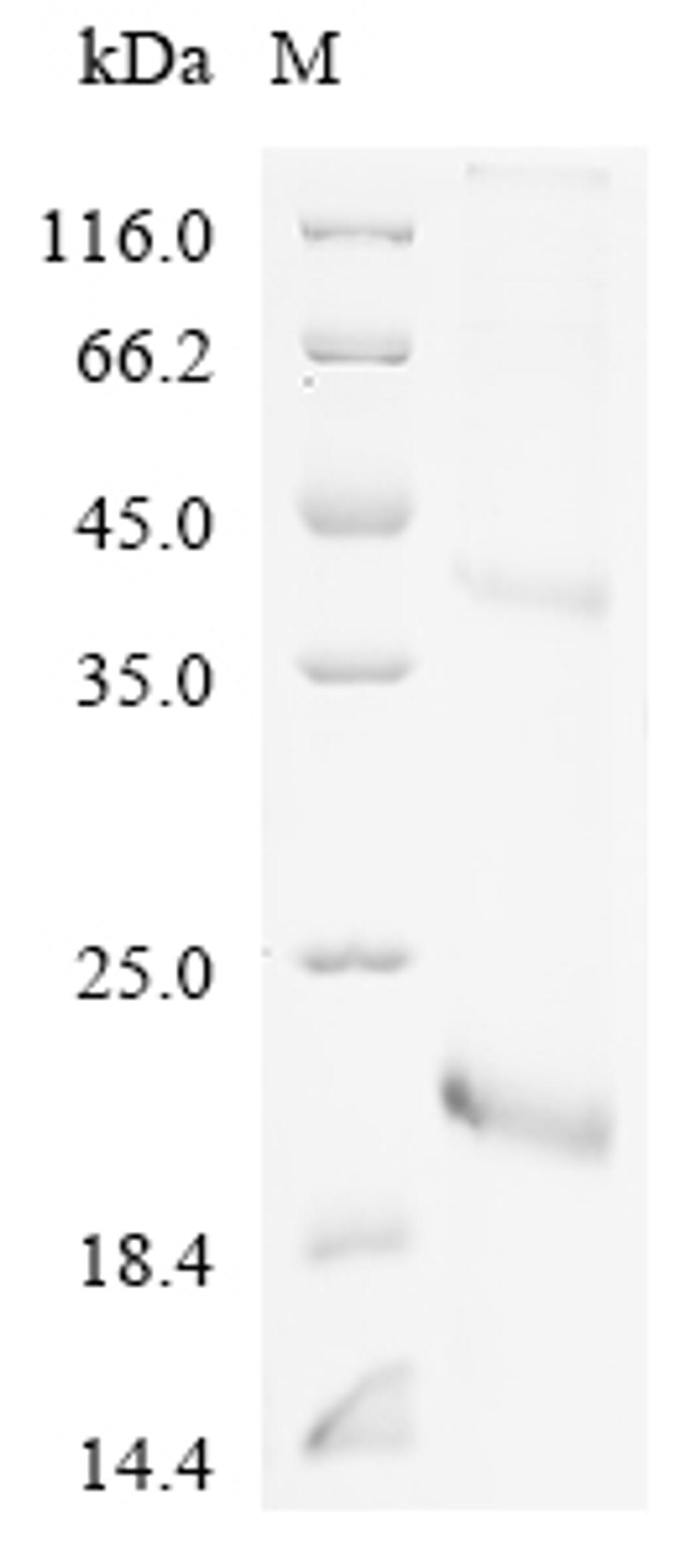 (Tris-Glycine gel) Discontinuous SDS-PAGE (reduced) with 5% enrichment gel and 15% separation gel.