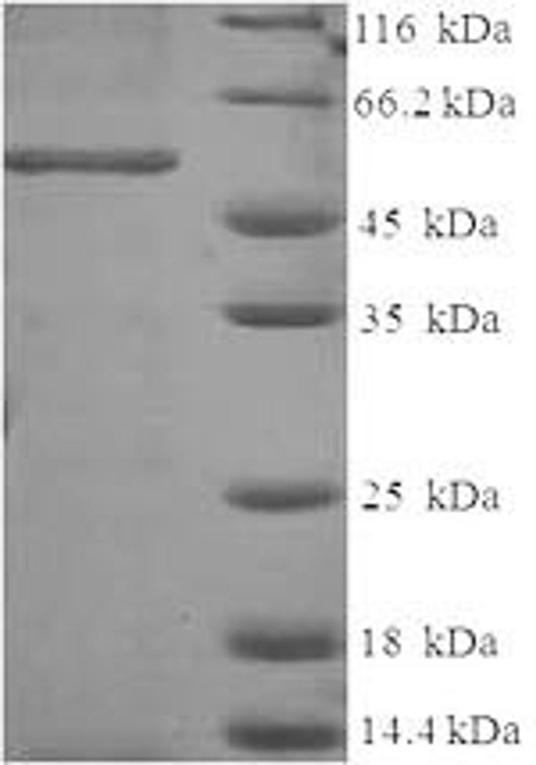 (Tris-Glycine gel) Discontinuous SDS-PAGE (reduced) with 5% enrichment gel and 15% separation gel.
