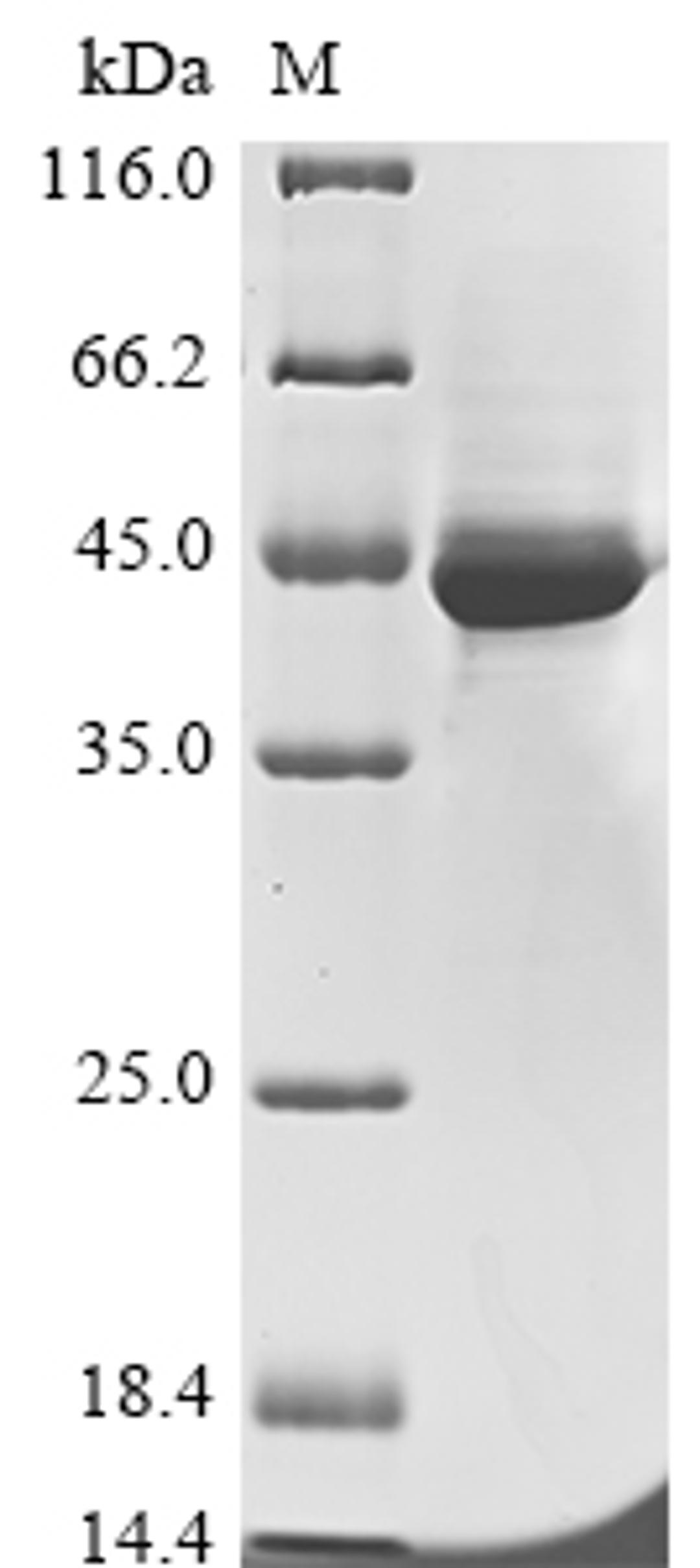 (Tris-Glycine gel) Discontinuous SDS-PAGE (reduced) with 5% enrichment gel and 15% separation gel.