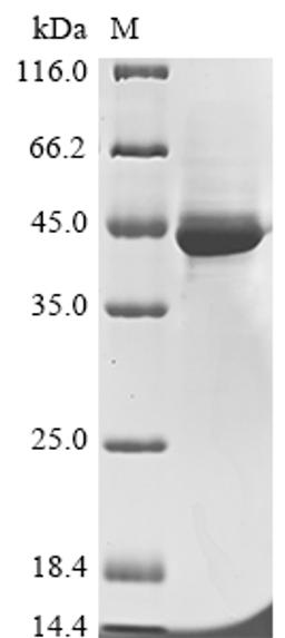 (Tris-Glycine gel) Discontinuous SDS-PAGE (reduced) with 5% enrichment gel and 15% separation gel.