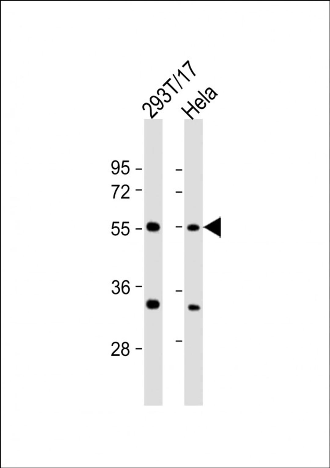 Western Blot at 1:2000 dilution Lane 1: 293T/17 whole cell lysate Lane 2: Hela whole cell lysate Lysates/proteins at 20 ug per lane.