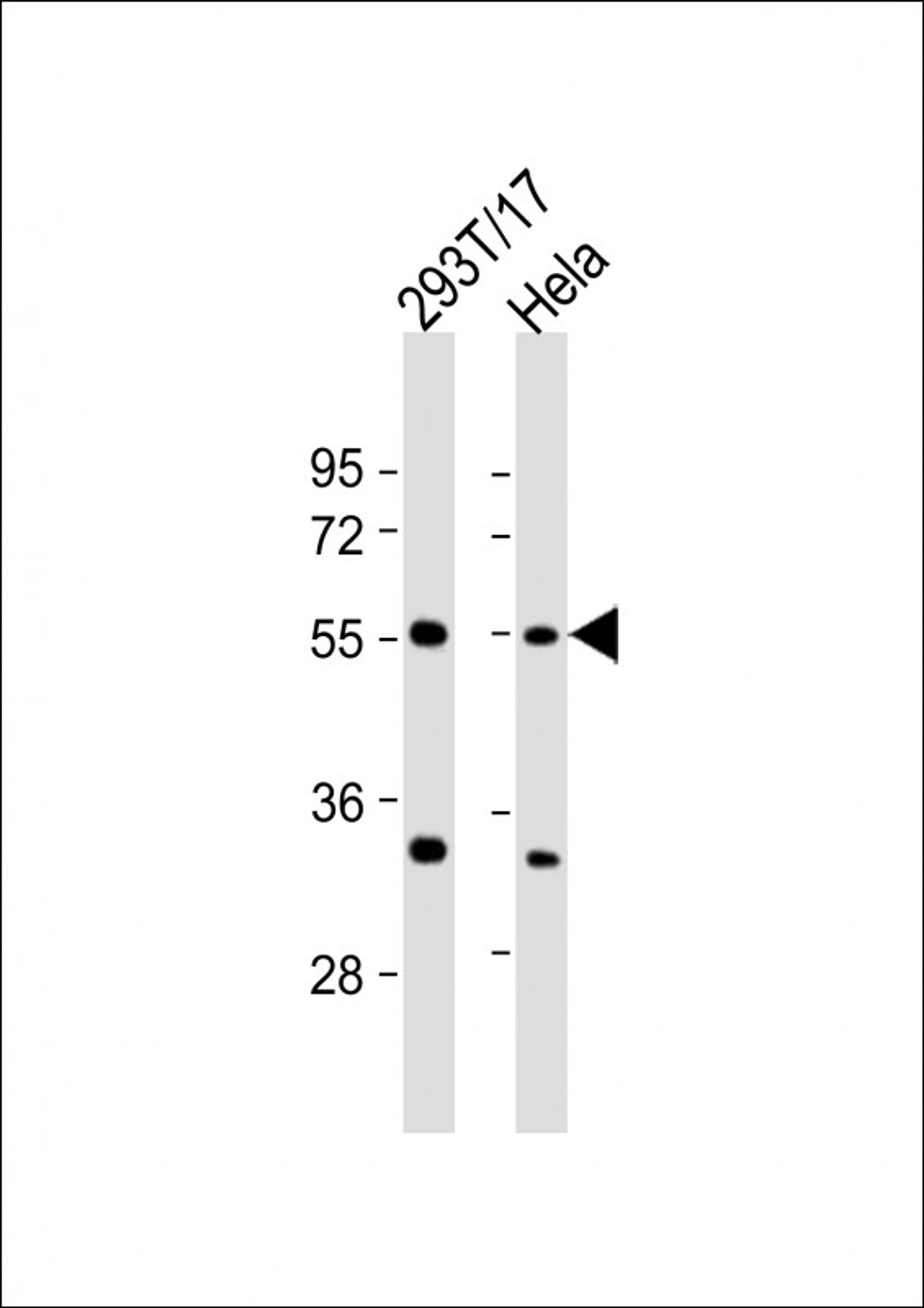 Western Blot at 1:2000 dilution Lane 1: 293T/17 whole cell lysate Lane 2: Hela whole cell lysate Lysates/proteins at 20 ug per lane.