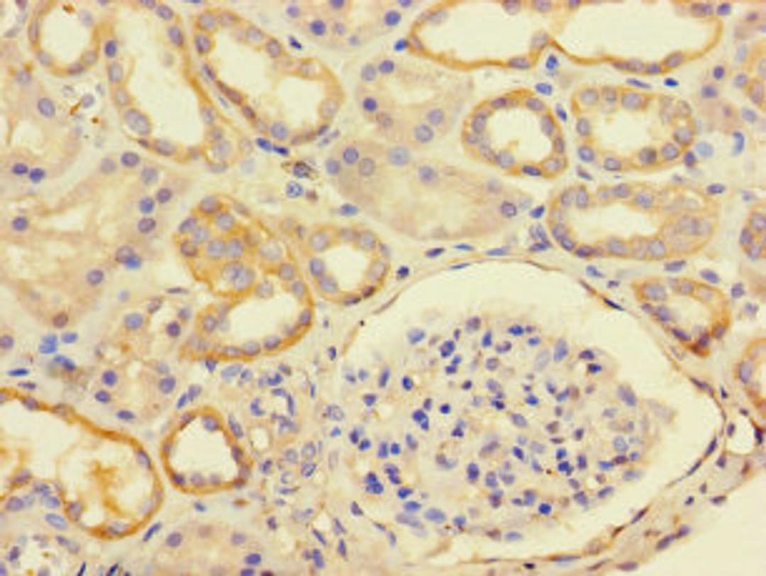 Immunohistochemistry of paraffin-embedded human kidney tissue using CSB-PA719466LA01HU at dilution of 1:100