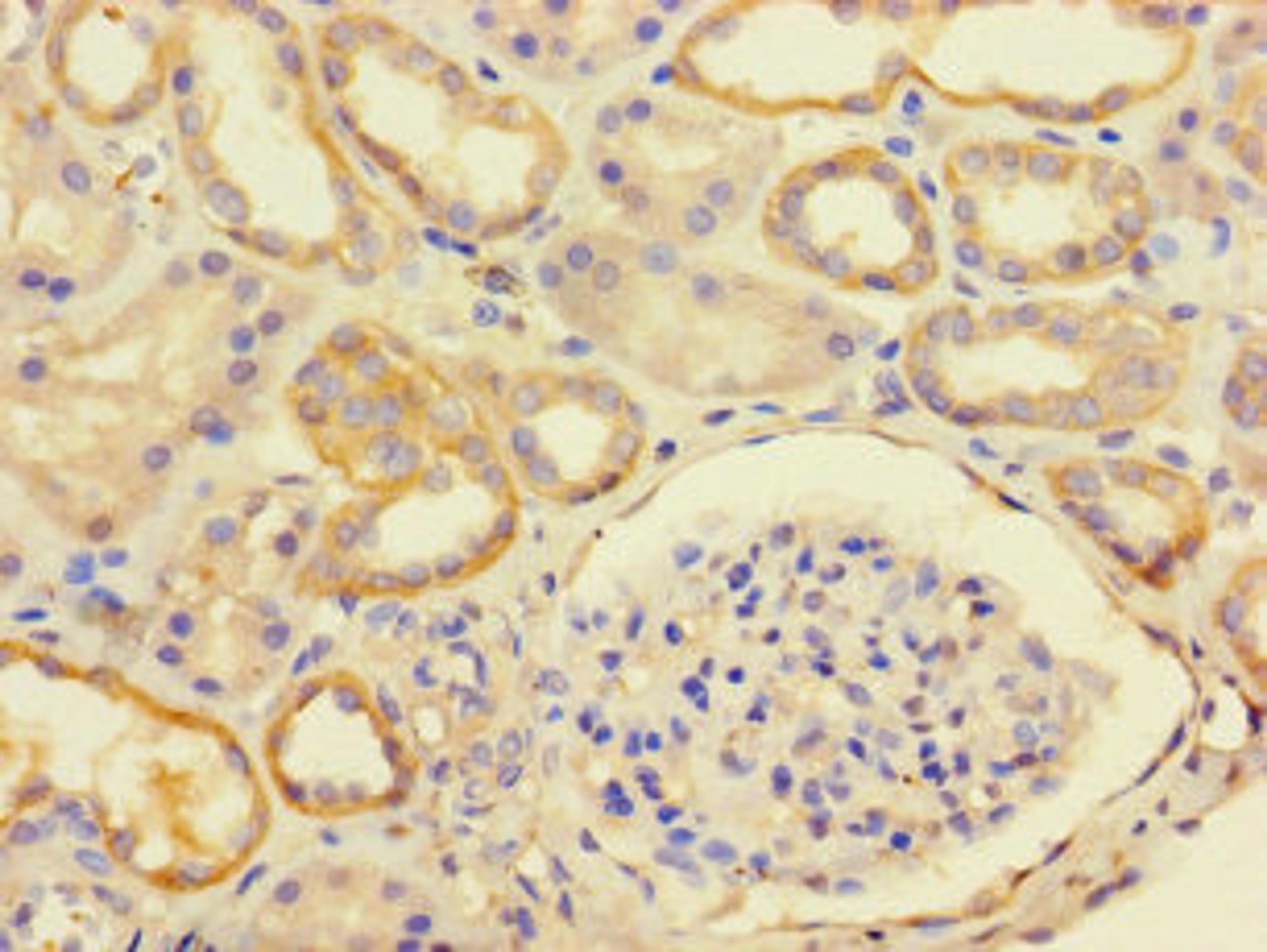 Immunohistochemistry of paraffin-embedded human kidney tissue using CSB-PA719466LA01HU at dilution of 1:100