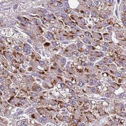 Immunohistochemistry: WDR90 Antibody [NBP2-31888] - Immunohistochemical staining of human placenta shows distinct membranous positivity in decidual cells.