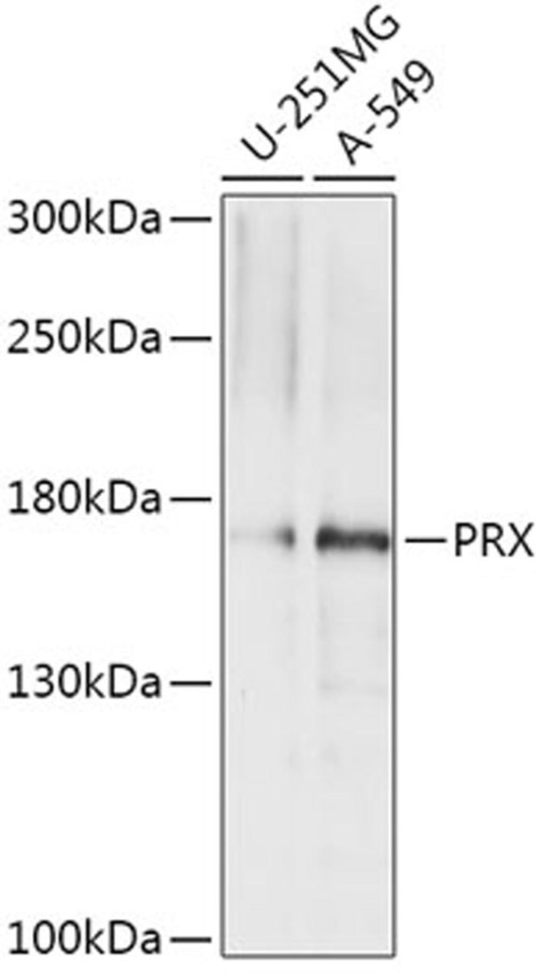 Western blot - PRX antibody (A17744)