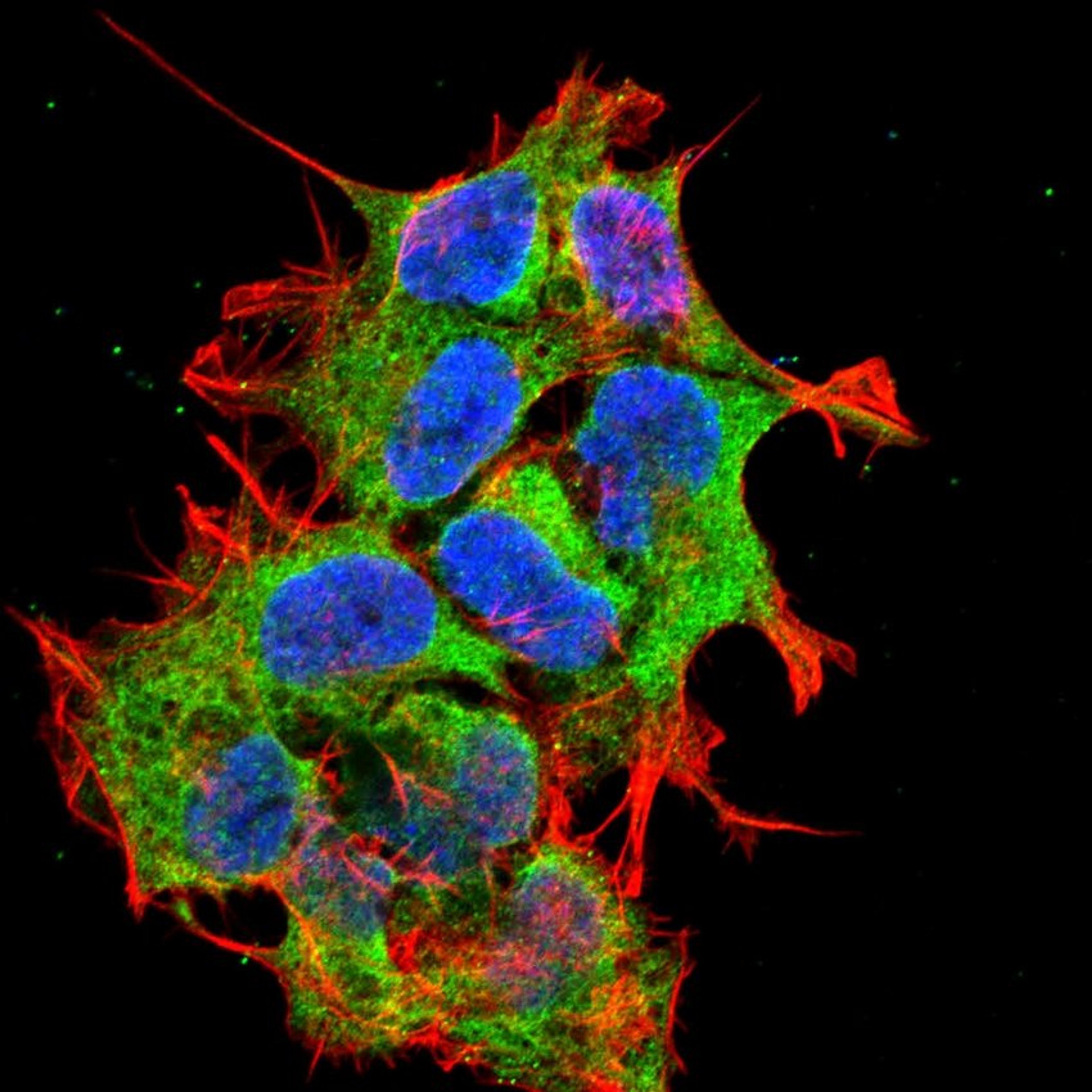 Immunofluorescence analysis of neuroblastoma cell line sk-n-be using GRP170 antibody