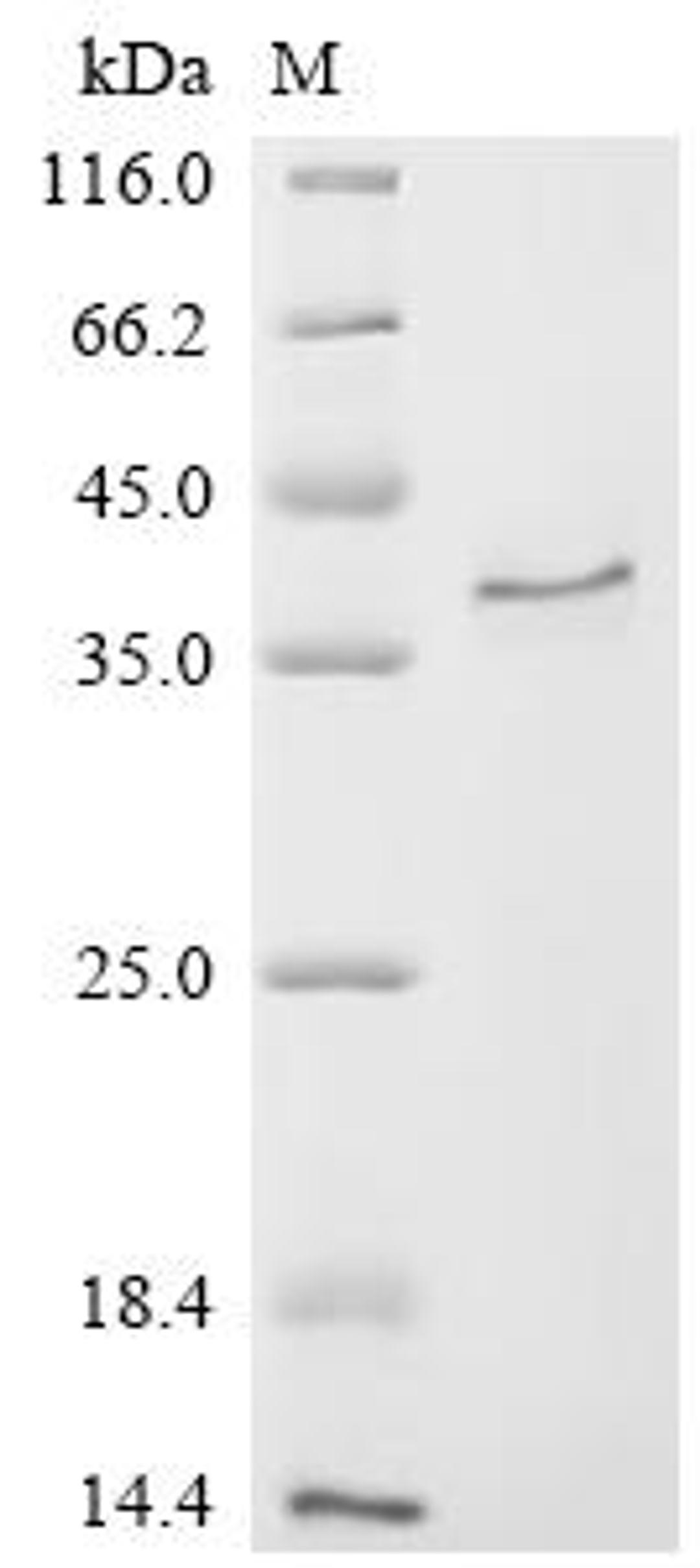 (Tris-Glycine gel) Discontinuous SDS-PAGE (reduced) with 5% enrichment gel and 15% separation gel.