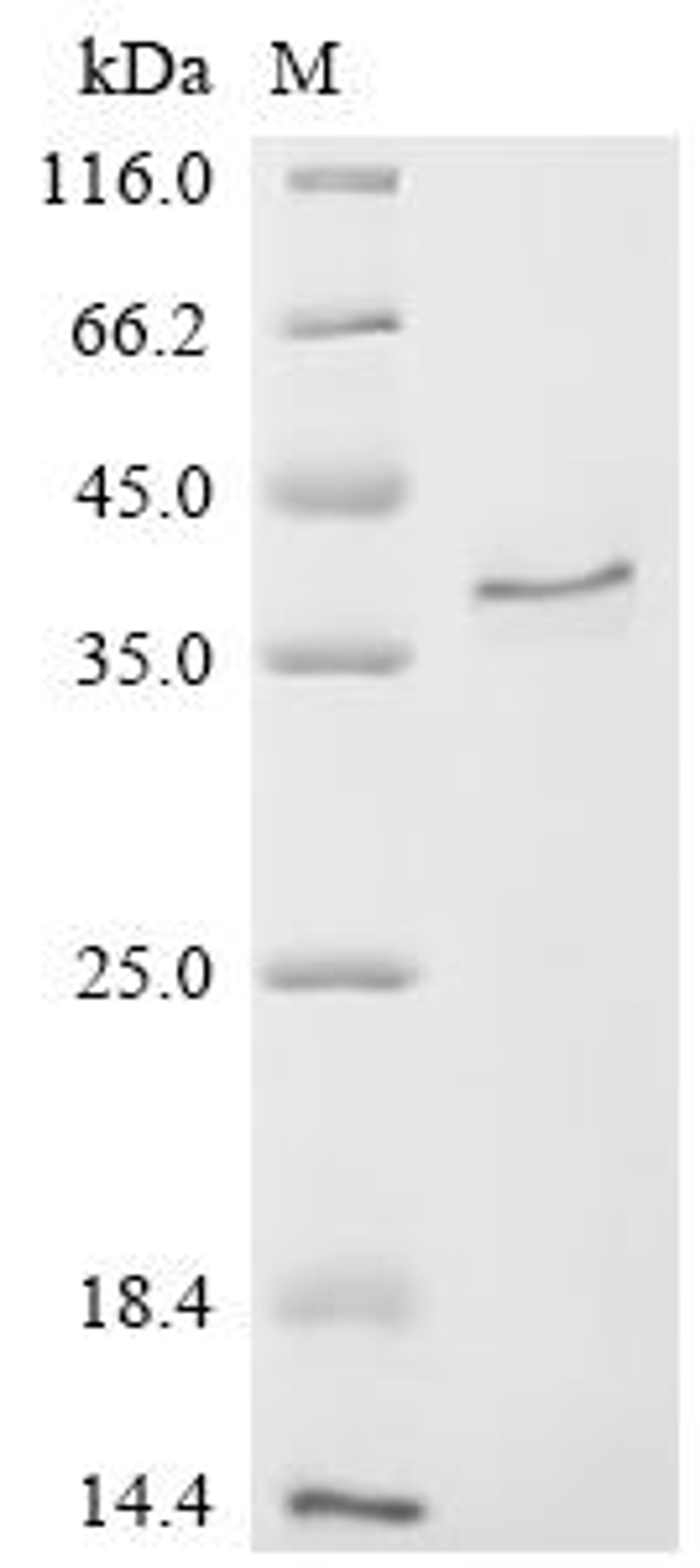 (Tris-Glycine gel) Discontinuous SDS-PAGE (reduced) with 5% enrichment gel and 15% separation gel.
