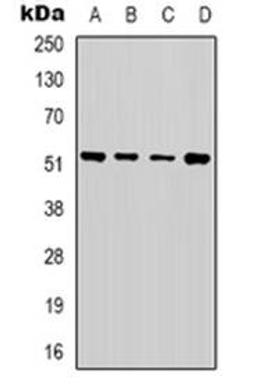 Western blot analysis of Alpha-tubulin expression in Hela (Lane 1), A549 (Lane 2), MCF7 (Lane 3), NIH3T3 (Lane 4) whole cell lysates using TUBA1A antibody