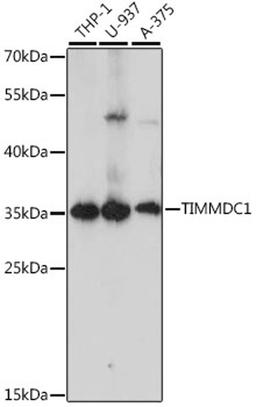 Western blot - TIMMDC1 antibody (A15839)