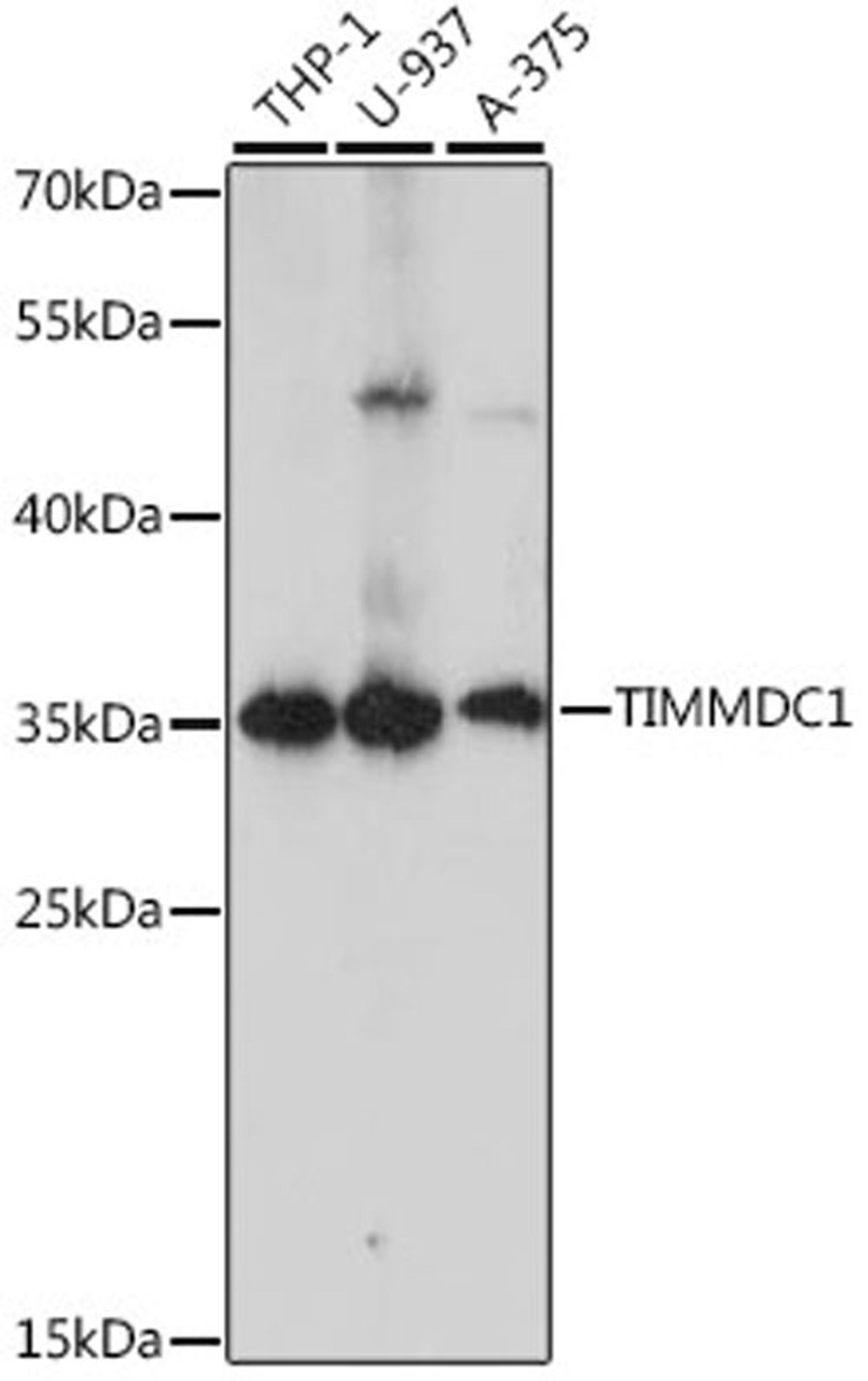 Western blot - TIMMDC1 antibody (A15839)