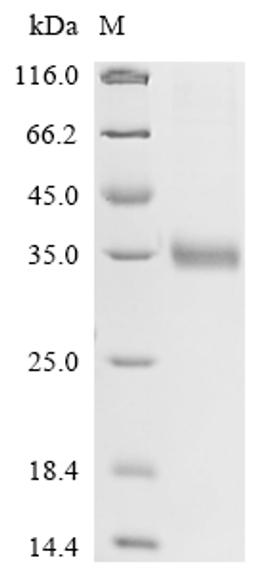 (Tris-Glycine gel) Discontinuous SDS-PAGE (reduced) with 5% enrichment gel and 15% separation gel.