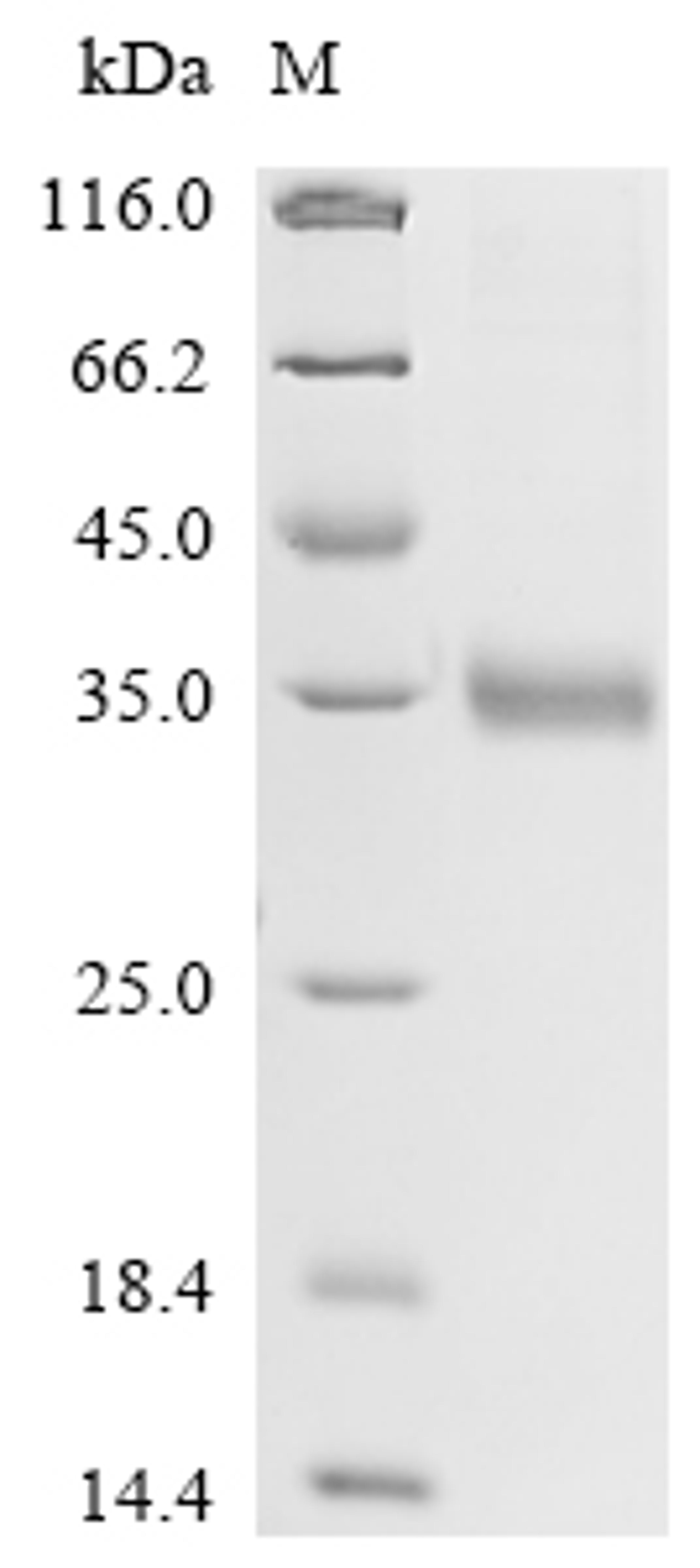 (Tris-Glycine gel) Discontinuous SDS-PAGE (reduced) with 5% enrichment gel and 15% separation gel.