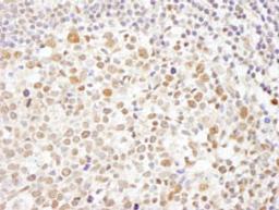 Detection of human Caf1p150 by immunohistochemistry.