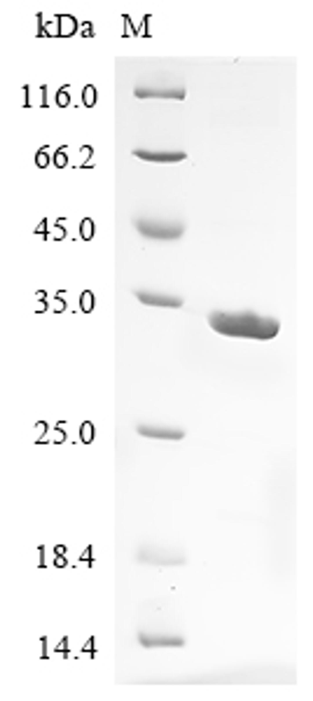 (Tris-Glycine gel) Discontinuous SDS-PAGE (reduced) with 5% enrichment gel and 15% separation gel.