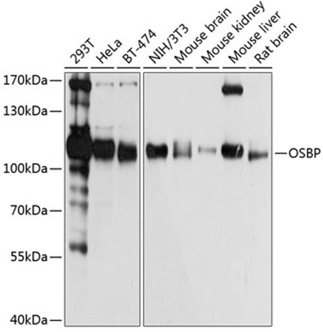 Western blot - OSBP antibody (A3998)