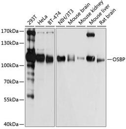 Western blot - OSBP antibody (A3998)