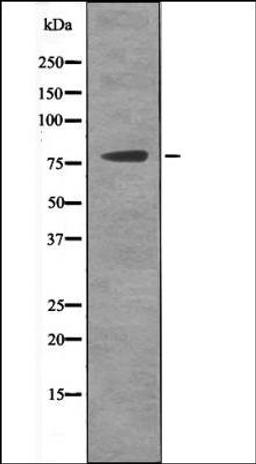 Western blot analysis of Etoposide treated 293 whole cell lysates using MSK2 -Phospho-Ser196- antibody