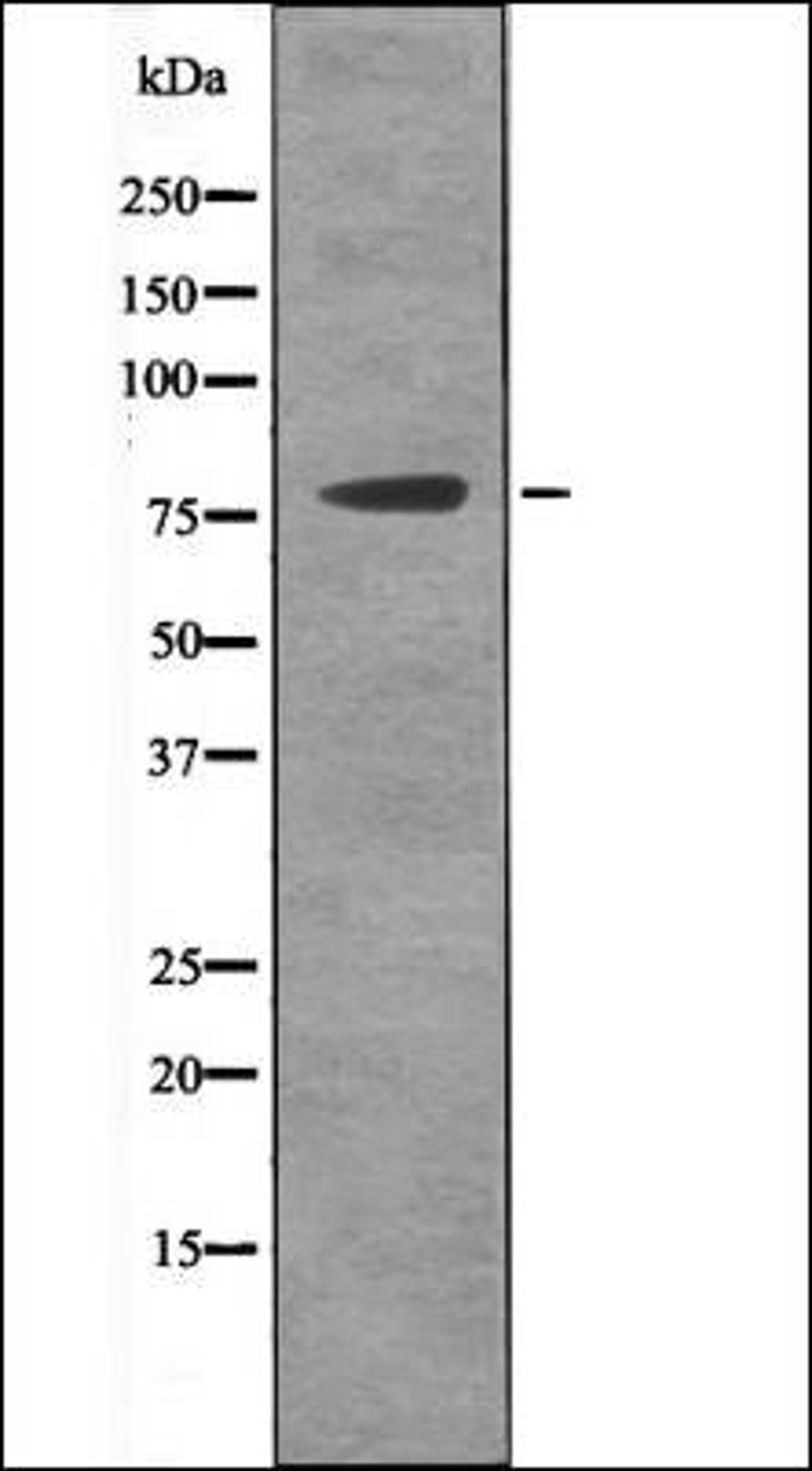 Western blot analysis of Etoposide treated 293 whole cell lysates using MSK2 -Phospho-Ser196- antibody