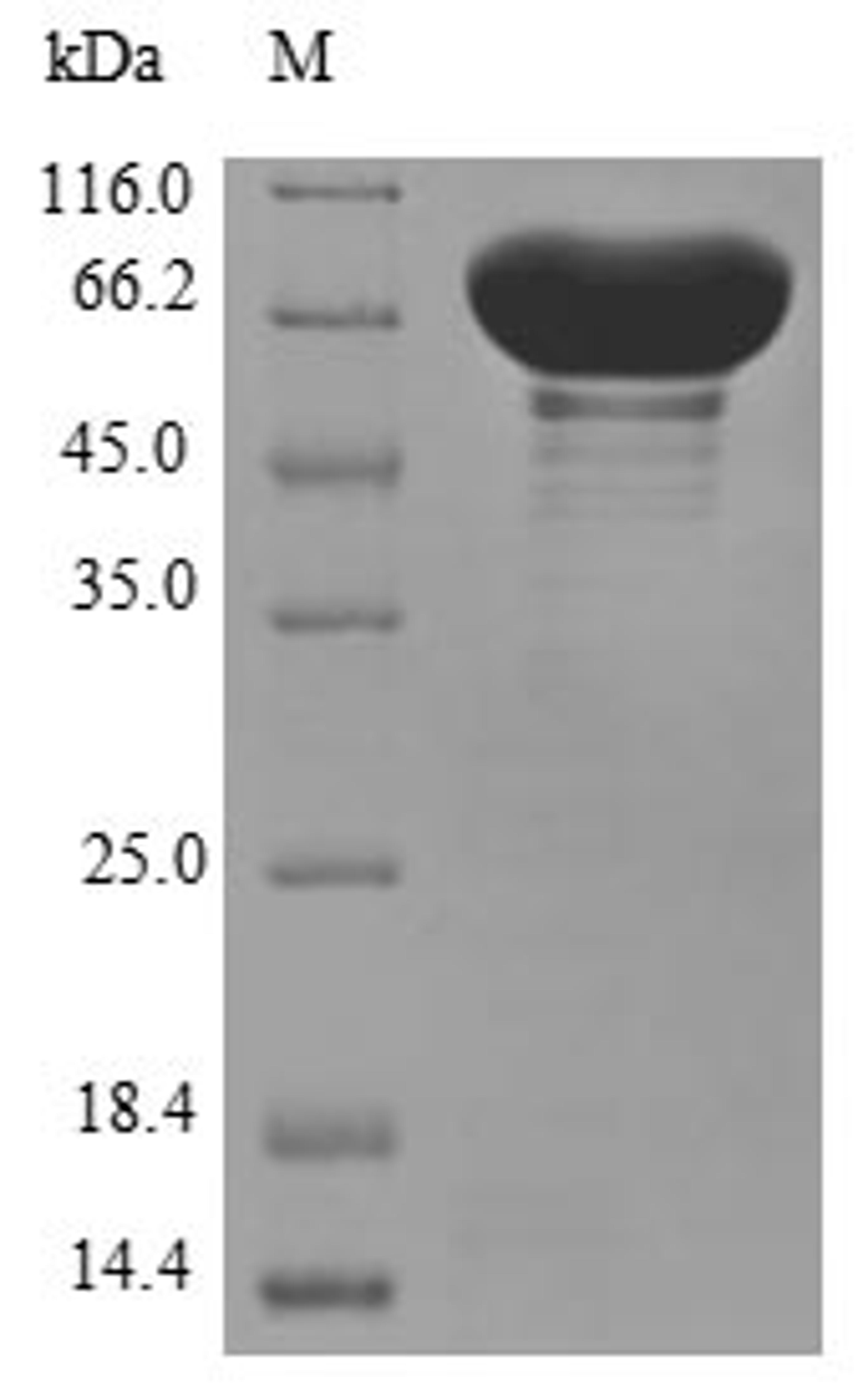(Tris-Glycine gel) Discontinuous SDS-PAGE (reduced) with 5% enrichment gel and 15% separation gel.