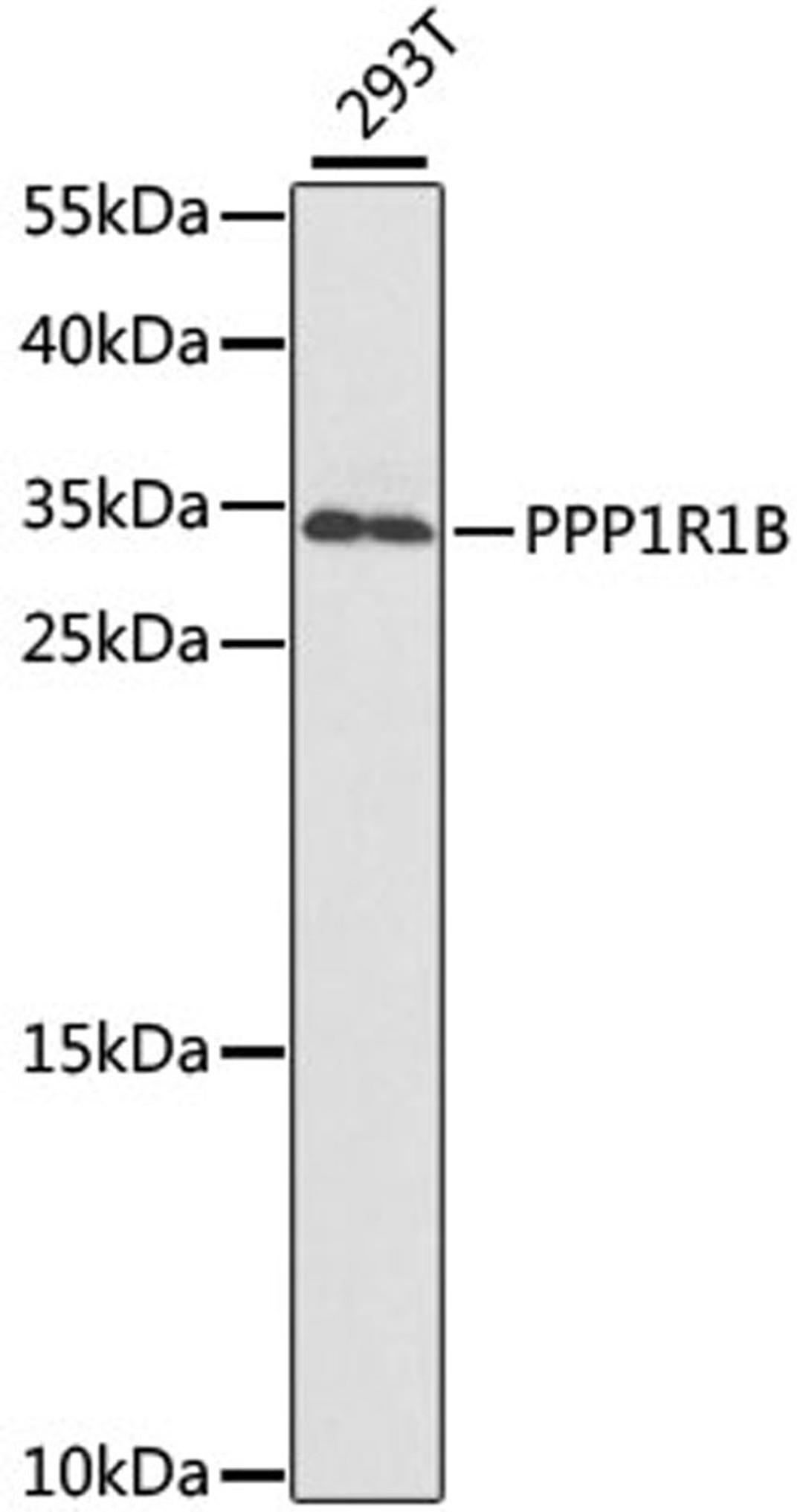 Western blot - PPP1R1B antibody (A2580)