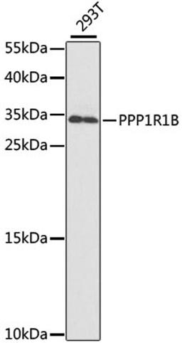 Western blot - PPP1R1B antibody (A2580)