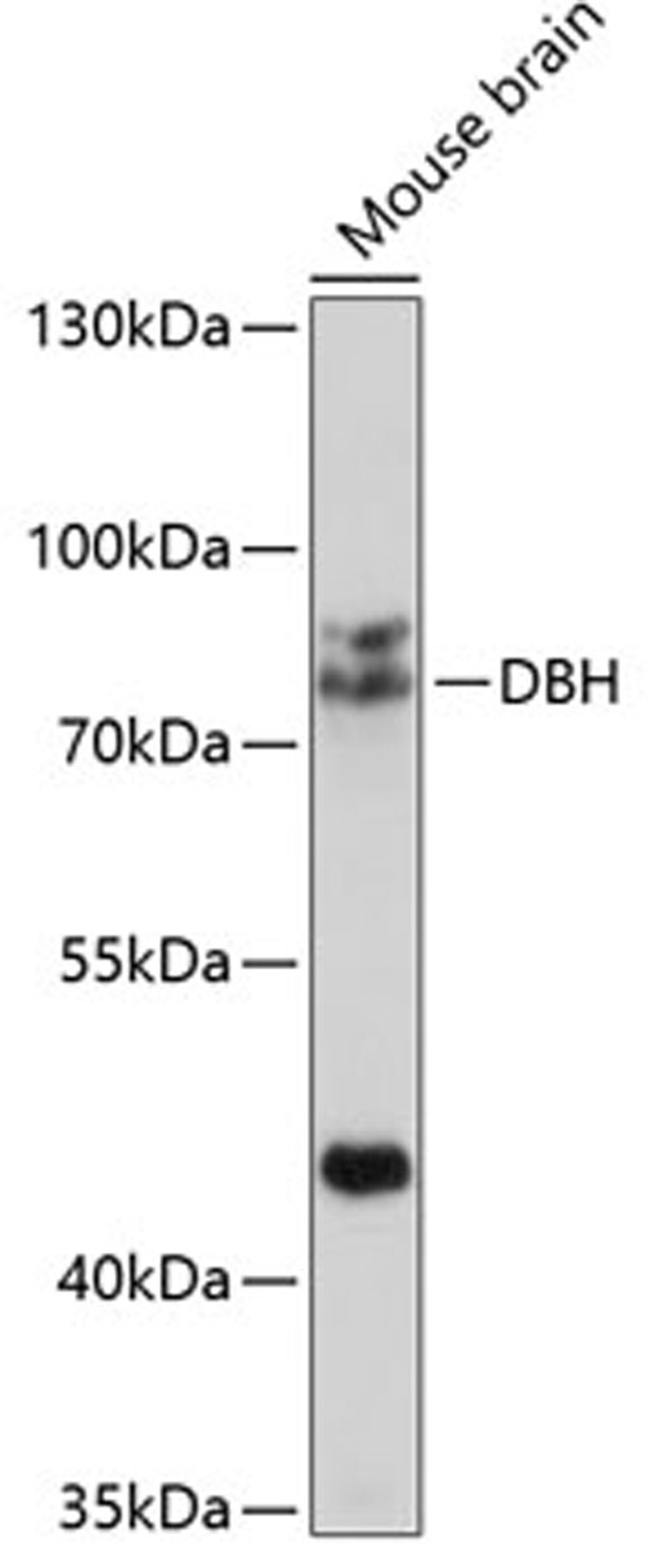 Western blot - DBH antibody (A2711)