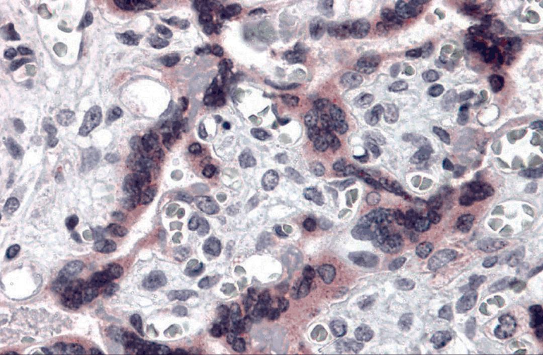 Immunohistochemistry of TTBK2 in human placenta tissue with TTBK2 antibody at 5 μg/mL.