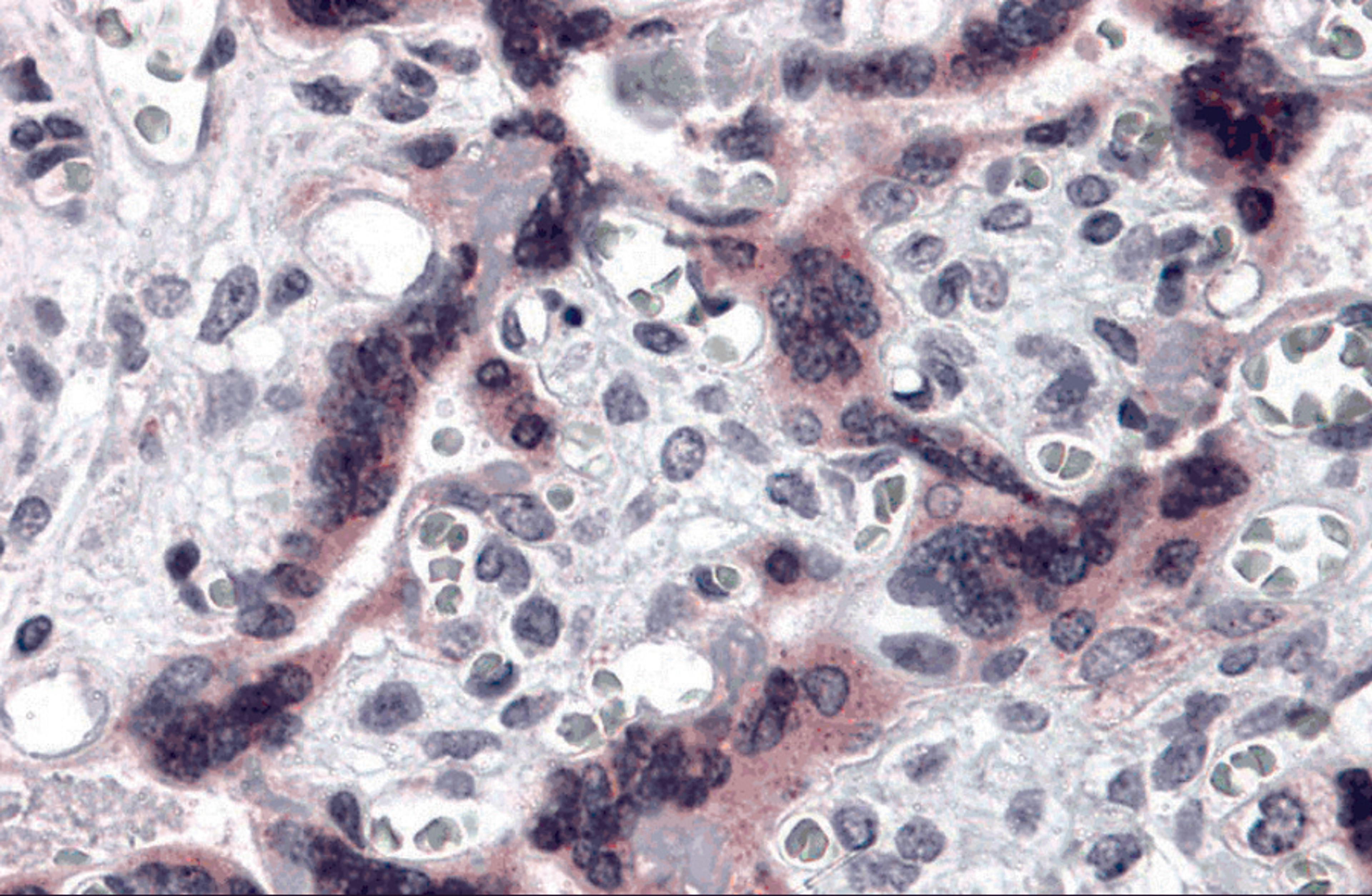 Immunohistochemistry of TTBK2 in human placenta tissue with TTBK2 antibody at 5 μg/mL.