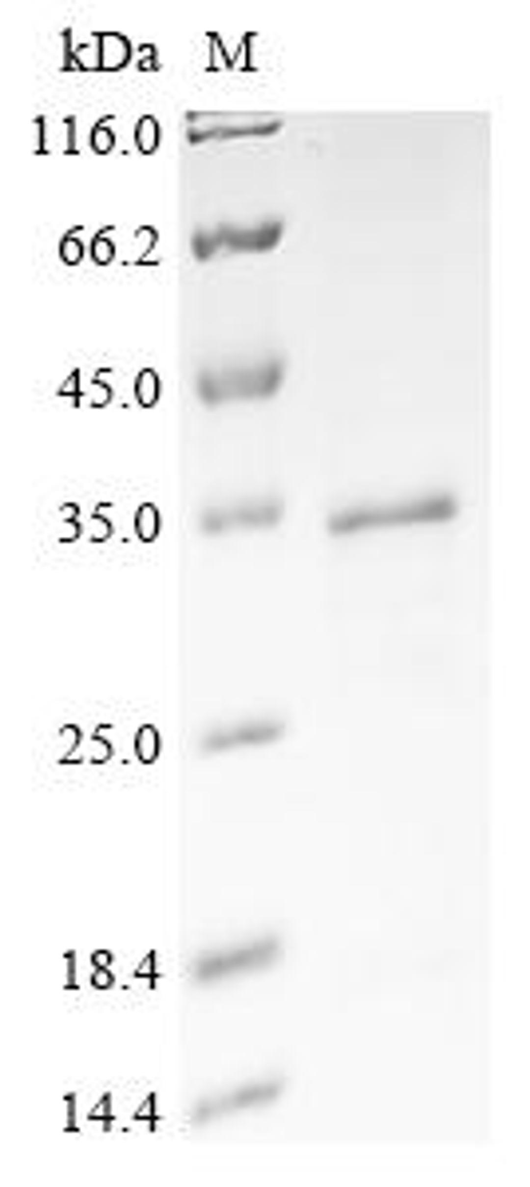 (Tris-Glycine gel) Discontinuous SDS-PAGE (reduced) with 5% enrichment gel and 15% separation gel.