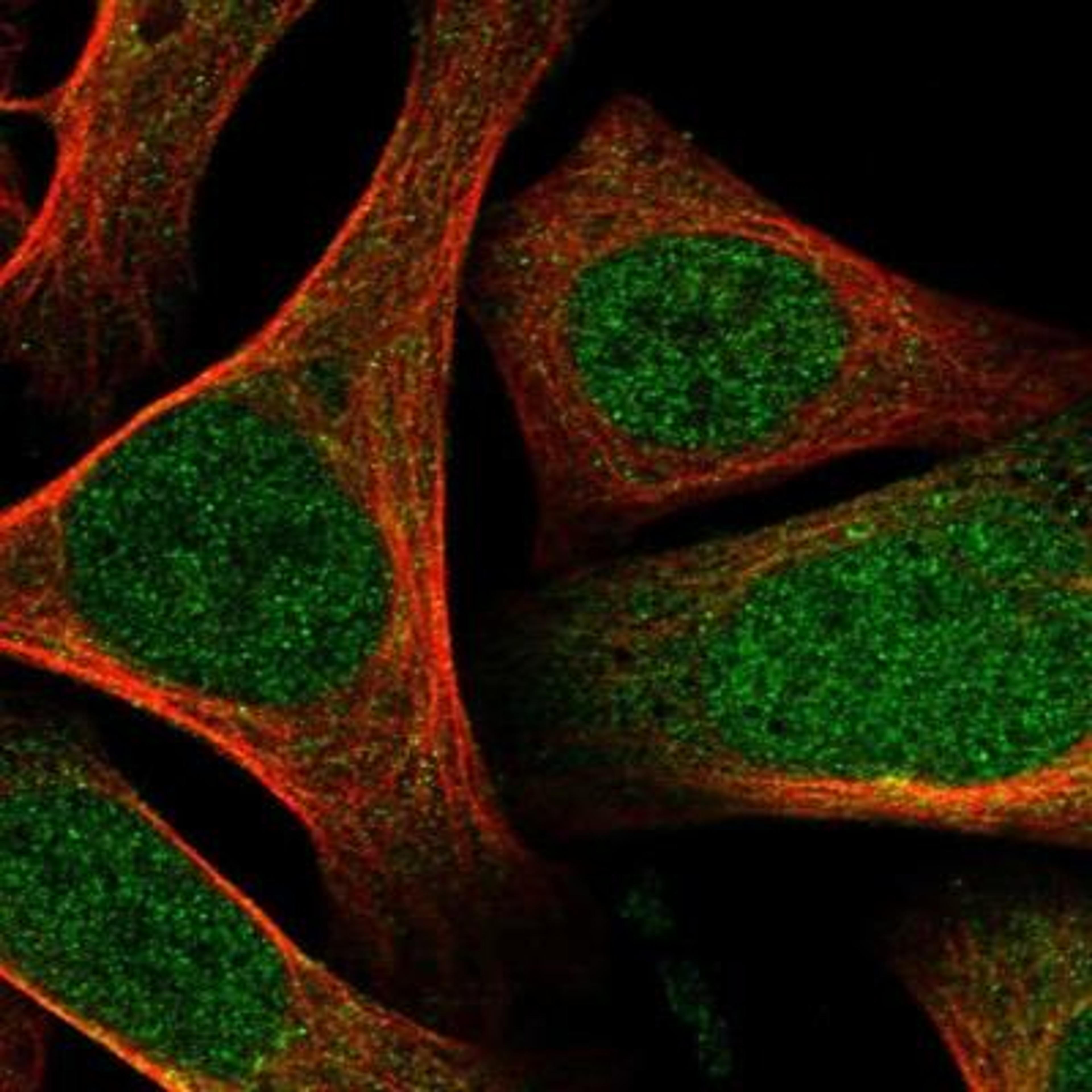 Immunocytochemistry/Immunofluorescence: ARK5/NUAK1 Antibody [NBP1-88986] - Staining of human cell line U-2 OS shows positivity in nucleus but not nucleoli, cytoplasm & golgi apparatus.