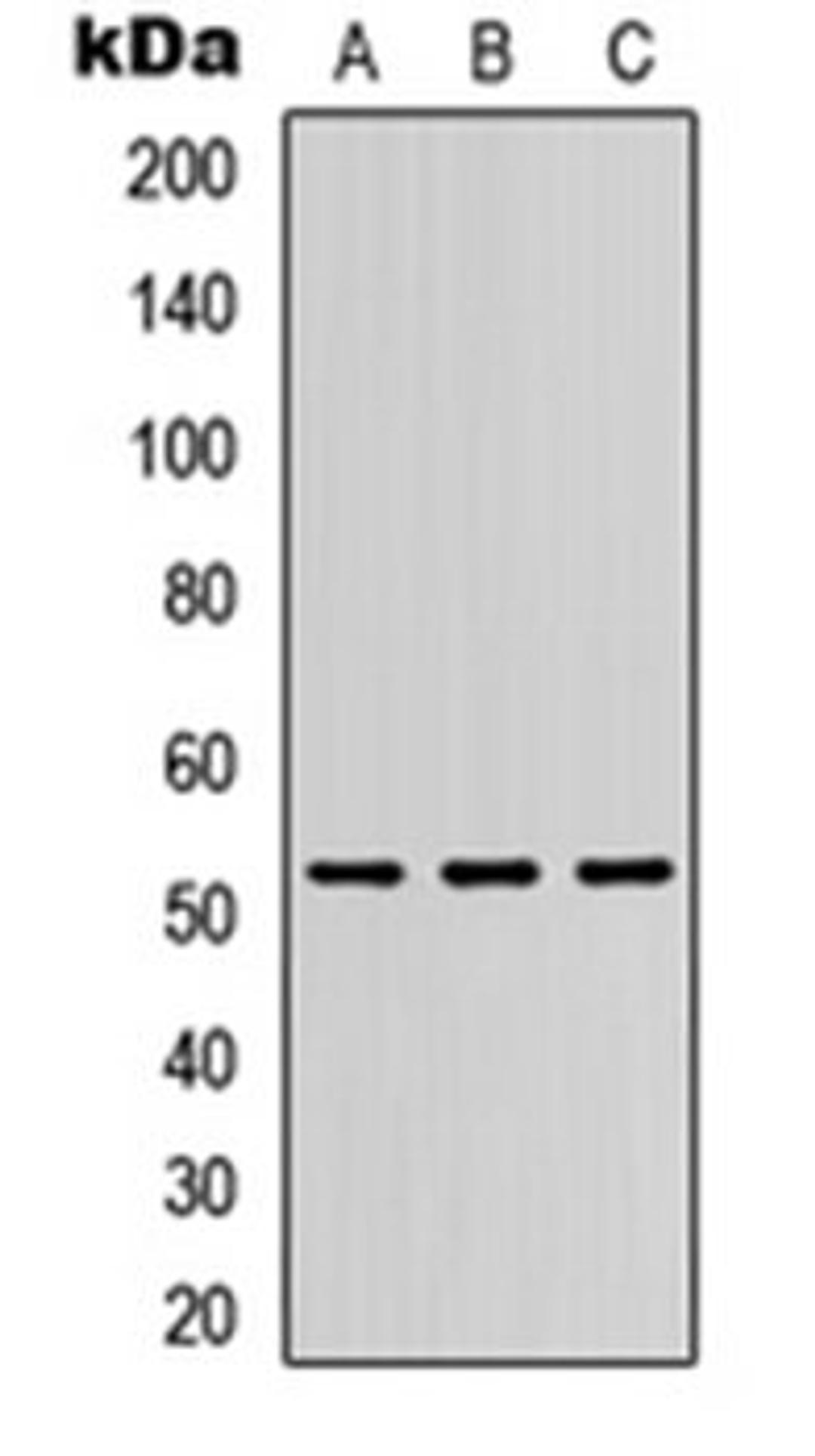 Western blot analysis of HEK293T (Lane 1), Raw264.7 (Lane 2), PC12 (Lane 3) whole cell lysates using DMRTA1 antibody