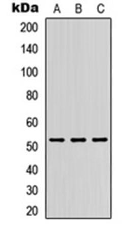 Western blot analysis of HEK293T (Lane 1), Raw264.7 (Lane 2), PC12 (Lane 3) whole cell lysates using DMRTA1 antibody