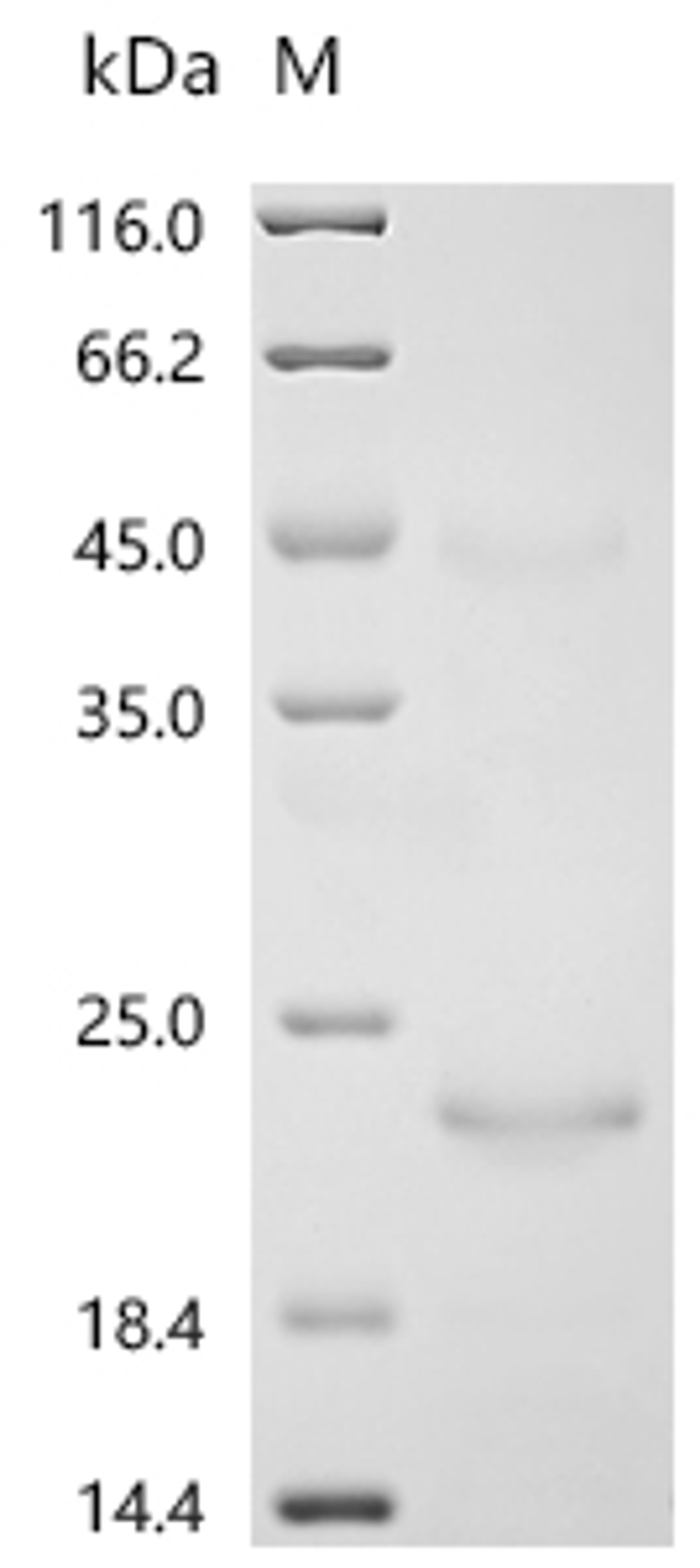 (Tris-Glycine gel) Discontinuous SDS-PAGE (reduced) with 5% enrichment gel and 15% separation gel.