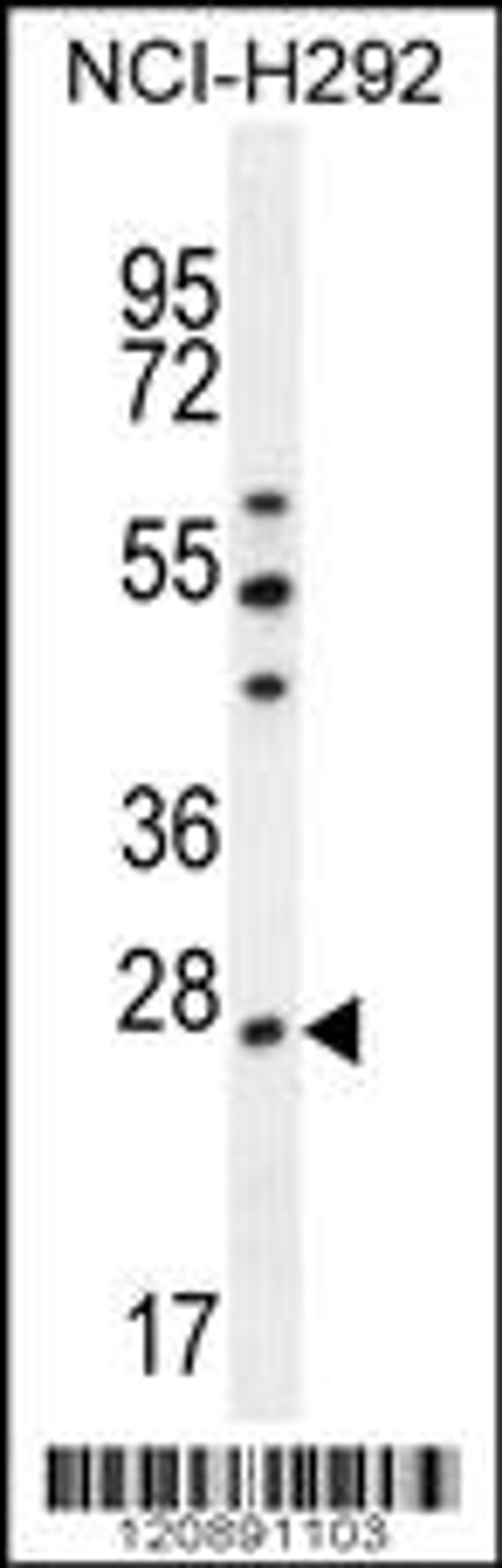 Western blot analysis in NCI-H292 cell line lysates (35ug/lane).