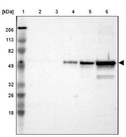 Immunohistochemistry: Fibrinopeptide B Antibody [NBP1-90956] - Lane 1: Marker [kDa] 206, 113, 82, 49, 32, 26, 18<br/>Lane 2: Human cell line RT-4<br/>Lane 3: Human cell line U-251MG sp<br/>Lane 4: Human cell line A-431<br/>Lane 5: Human liver tissue<br/>Lane 6: Human tonsil tissue