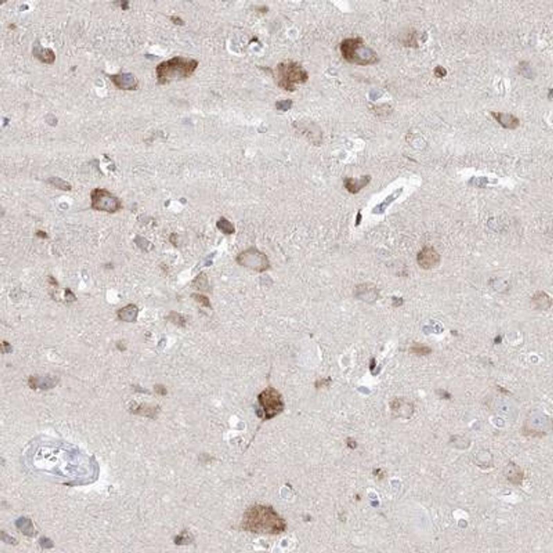 Immunohistochemistry: GABA-A R gamma 1 Antibody [NBP1-91003] - Staining of human cerebral cortex shows moderate cytoplasmic positivity in neuronal cells.