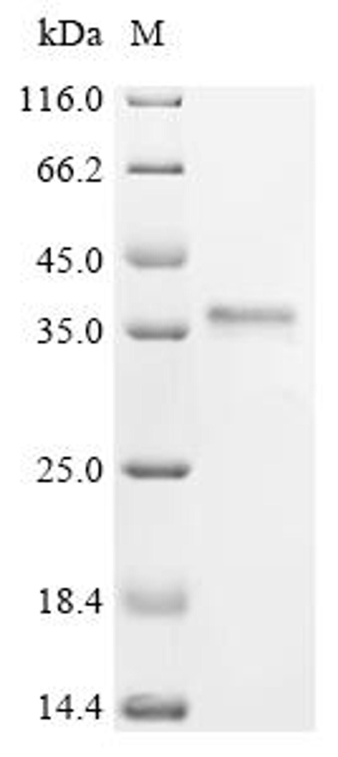 (Tris-Glycine gel) Discontinuous SDS-PAGE (reduced) with 5% enrichment gel and 15% separation gel.